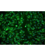 Human Amniotic Mesenchymal Stromal Cells (HAMSC) - Immunostaining for CD105, 200x.
