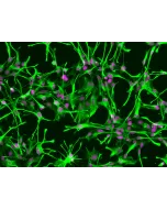 Human Astrocytes (HA) - Immunostaining for GFAP, 200x.