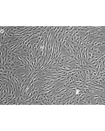 HumanBone Marrow-derived_Mesenchymal_Stem_Cells (HMSC-bm) – Phase contrast, 100x.
