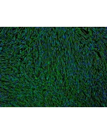 Human Bronchial Fibroblasts (HBF) - Immunostaining for Fibronectin, 100x.
