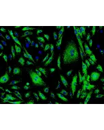 Human Cardiac Microvascular Endothelial Cells (HCMEC) - Immunostaining for vWF, 200x.
