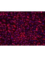 Human Cervical Epithelial Cells (HCerEpiC)-Immunostaining for CK-18, 200x.