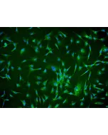 Human Chorionic Mesenchymal Stromal Cells (HCMSC) - Immunostaining for CD105, 200x.
