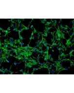 Human_Dermal_Fibroblasts-adult (HDF-a) - Immunostaining for Fibronectin, 200x.
