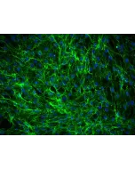 Human Dermal Fibroblasts-fetal (HDF-f) - Immunostaining for Fibronectin, 200x.
