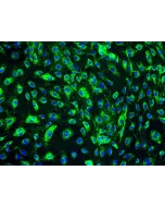 Human Dermal Lymphatic Endothelial Cells (HDLEC) - Immunostaining for vWF, 200x.
