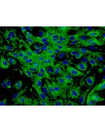 Human Dermal Microvascular Endothelial Cells (HDMEC) - Immunostaining for vWF, 400x.
