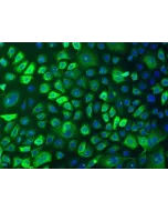 Human Epidermal Keratinocytes-adult (HEK-a) - Immunostaining for CK-18, 100x.
