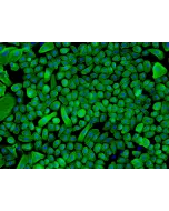 Human Epidermal Keratinocytes-neonatal (HEK-n) - Immunostaining for CK-18, 200x.