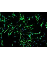 Human Epidermal Melanocyte-adult (HEM-a) - Immunostaining for S100-β, 100x.