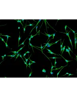 Human Epidermal Melanocytes-dark (HEM-d) - Immunostaining for Vimentin, 200x.