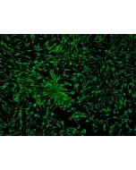 Human Epidermal Melanocytes-light (HEM-l) - Immunostaining for S100-β, 100x.