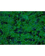 Human Hepatocytes (HH) - Immunostaining for CK-18, 100x.
