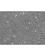 Human Liver-derived Mesenchymal Stem Cells (HMSC-he) - Phase contrast, 100x.
