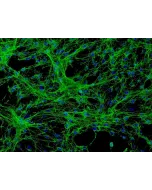 Human Meningeal Cells (HMC) - Immunostaining for Fibronectin, 200x.