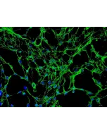 Human Osteoblasts-femoral (HO-f) - Immunostaining for Fibronectin, 200x.