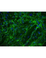 Human Ovarian Fibroblasts (HOF) - Immunostaining for Fibronectin, 200x.
