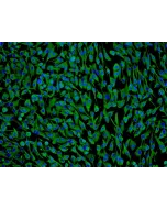 Human Perineurial Cells (HPNC) - Immunostaining for Vimentin, 100x.
