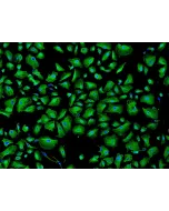 Human Pulmonary Alveolar Epithelial Cells (HPAEpiC) - Immunostaining for CK-18, 100x.