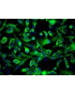 Human Renal Proximal Tubular Epithelial Cells (HRPTEpiC) - Immunostaining for CK-18, 200x.