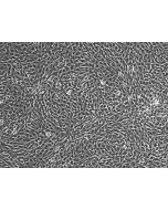 HUMAN SKELETAL MUSCLE MYOBLASTS (HSkMM)- phase contrast 100X