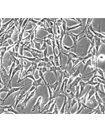Human Skeletal Muscle Satellite Cells (HSkMSC) - Phase contrast, 200x.