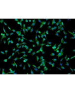 Human Umbilical Mesenchymal Stem Cells (HUMSC) - Immunostaining for CD73, 200x.
