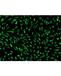 Human Induced Pluripotent Stem Cell-derived Astrocytes