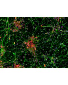 Human Pluripotent Stem Cell derived-Cortical Neurons immunostained for TBR1 (red) and beta tubulin III (green) 200X