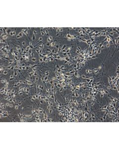 Human Pluripotent Stem Cell derived-Dopaminergic Neurons Phase Contrast 200X