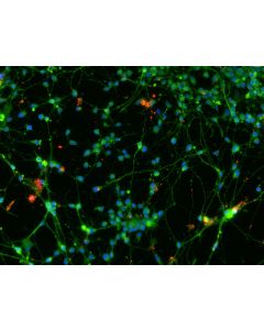 Human Pluripotent Stem Cell derived-Glutamatergic Neurons immunostained for vGLUT1 (red) and beta tubulin III (green) 200X