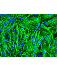 Mouse Astrocytes (MA) - Immunostaining for GFAP