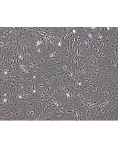 Mouse Pituitary Cells (MPC)-Phase Contrast, 100X