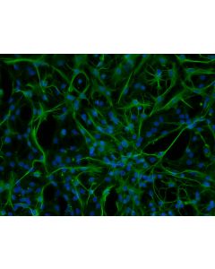 Rat Astrocytes-spinal cord (RA-sc)-Immunostaining for GFAP, 200X