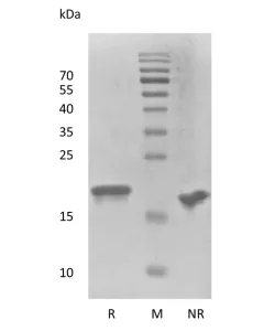 Recombinant Human Fibroblast Growth Factor-21 Thermostable