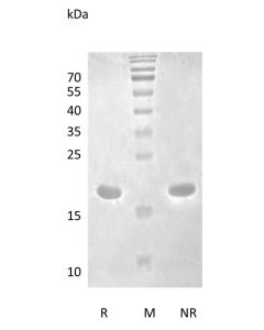 Recombinant Human Interleukin-1 beta