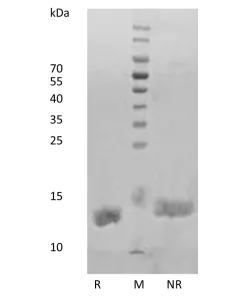 Recombinant Human Interleukin-2