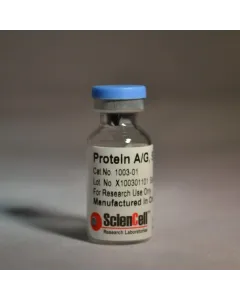 Recombinant Protein A/G