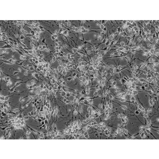 人中脑神经元（HN-mb）- 相差显微镜，200×
