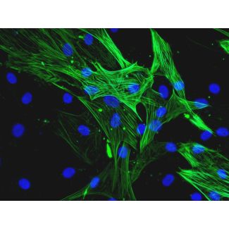 人冠状动脉平滑肌细胞（HCASMC）- α-SMA免疫染色，400倍（400×）
