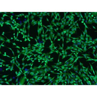 人真皮成纤维细胞-GFP（2310-GFP）– GFP荧光及Hoechst染色，100倍（100×）