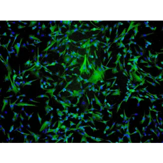 
人类星形胶质细胞-中脑（HA-mb）- GFAP免疫染色，100倍放大。
