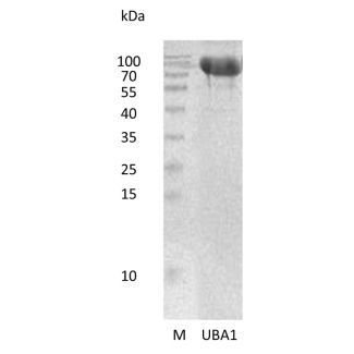 重组人泛素样修饰蛋白激活酶1（UBA1）