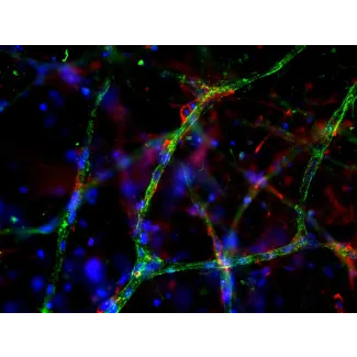 Day 9 post-embedding: Endothelial cells stained with VWF (green) and pericytes stained with NG2 (red), 200x
