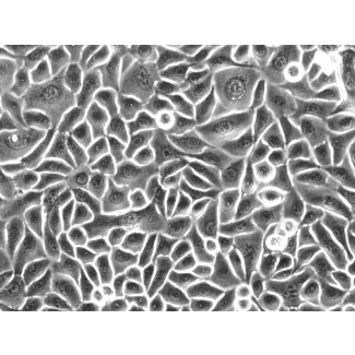 Human Esophageal Epithelial Cells (HEEpiC) - Phase contrast, 200x.
