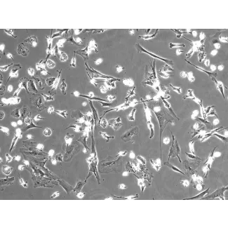 Human Hepatic Macrophages (HHMa) – Phase Contrast, 100x
