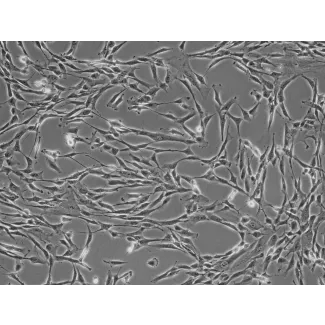 Human Pancreatic Stellate Cells (HPaSteC) - Phase contrast, 200x.
