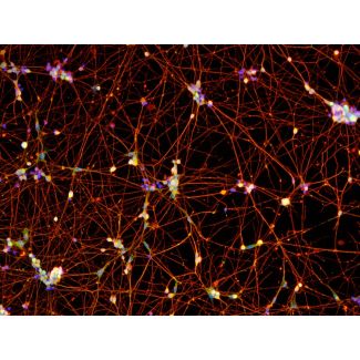 Human Pluripotent Stem Cell Derived-GABAergic Neurons  (HPSC-GABAN) -immunostained for Tubb3 (red) and GABA (green) 100X