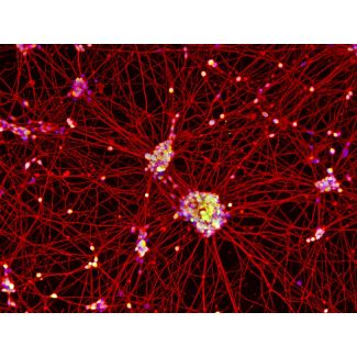 Human Pluripotent Stem Cell derived-Motor Neurons (HPSC-MN) - immunostained for Tubb3 (red) and Mnx1 (green) 100X