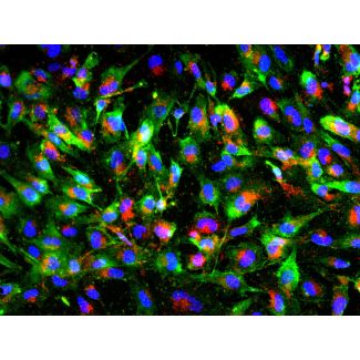 Human Pluripotent Stem Cell derived-Pericytes, immunostained for NG2 (green) and PDGFR-beta (red) 200X